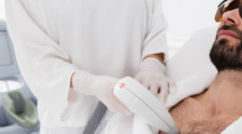 Épilation définitive au laser pour les hommes