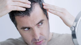 La perte de cheveux due au stress