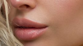 Les injections d’acide hyaluronique pour les lèvres: comment ça se passe?