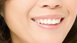 Injection acide hyaluronique Paris