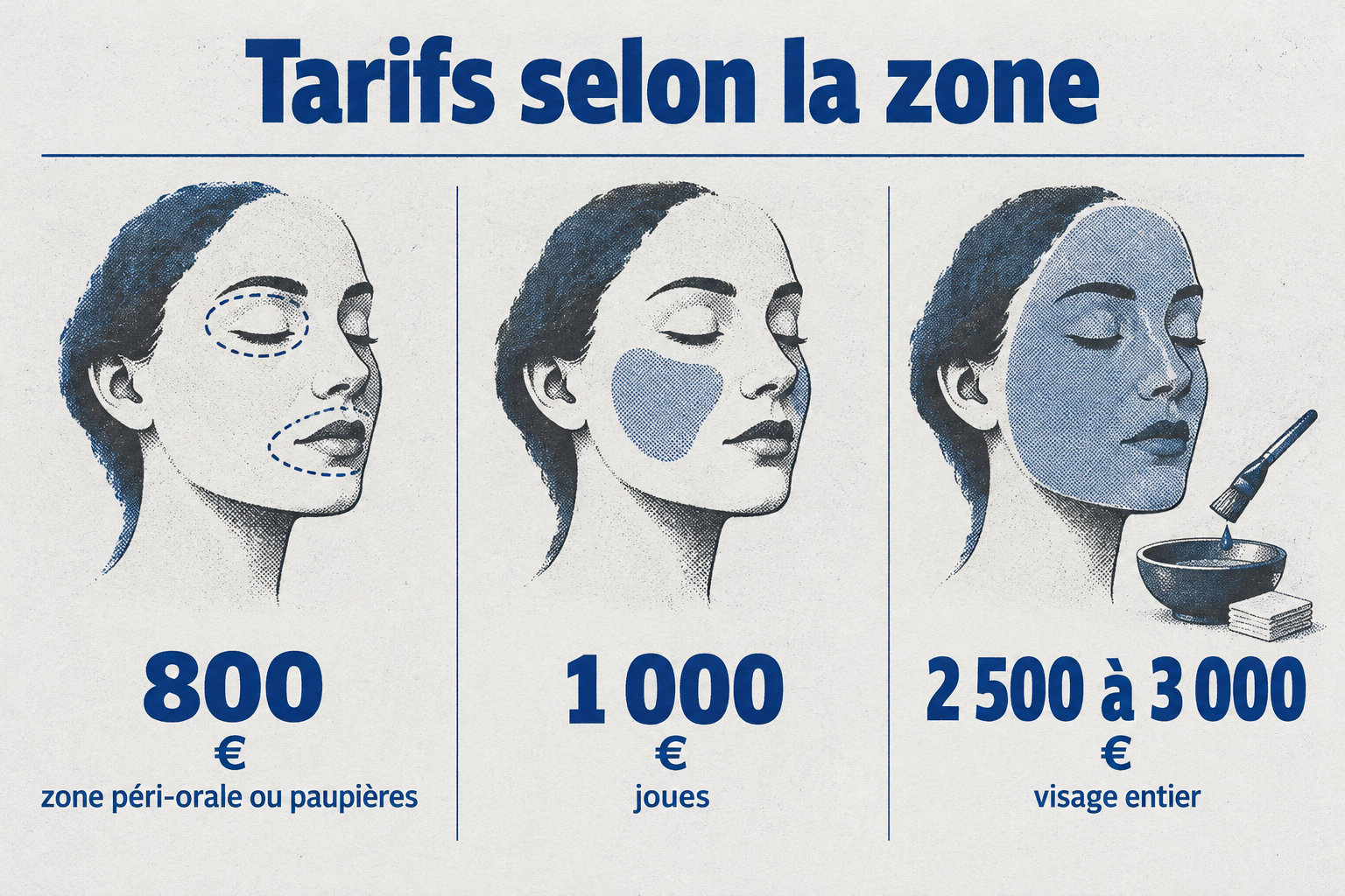 Les tarifs indiqués sont d’environ 800 € pour une zone péri-orale ou les paupières, 1 000 € pour les joues et 2 500 à 3 000 € pour le visage entier.